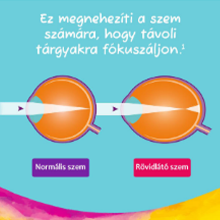 MiSight 1 day